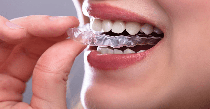Child Dentistry in Anand
