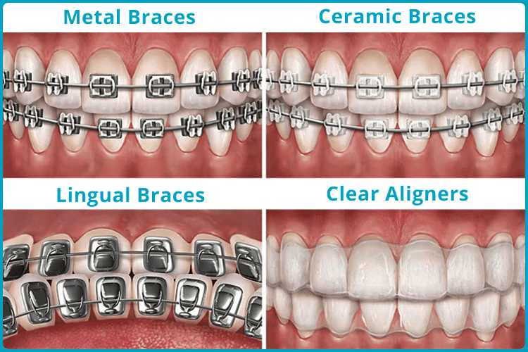 Cosmetic Dentistry in Anand